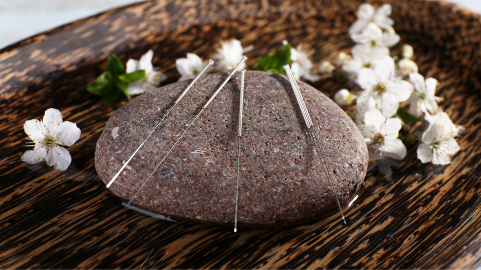 The Benefits of Nutritional Supplement Programs for Licensed Acupuncturists